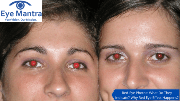 Indicate eyemantra Indicate eyemantra