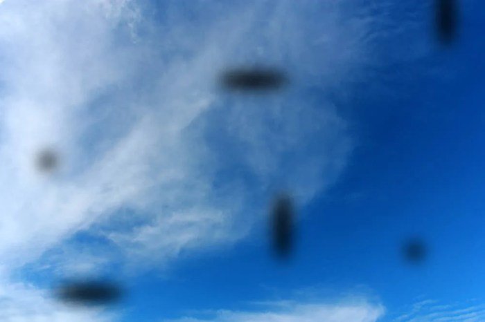 Mengapa eye floaters